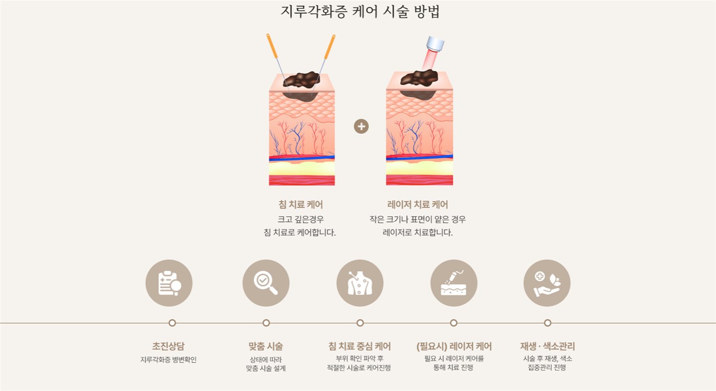 지루각화증 케어 시술 방법 — 침 치료 케어와 레이저 치료 케어